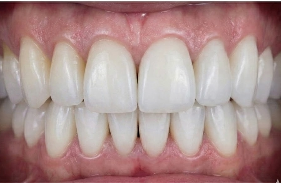 אחרי הטיפול