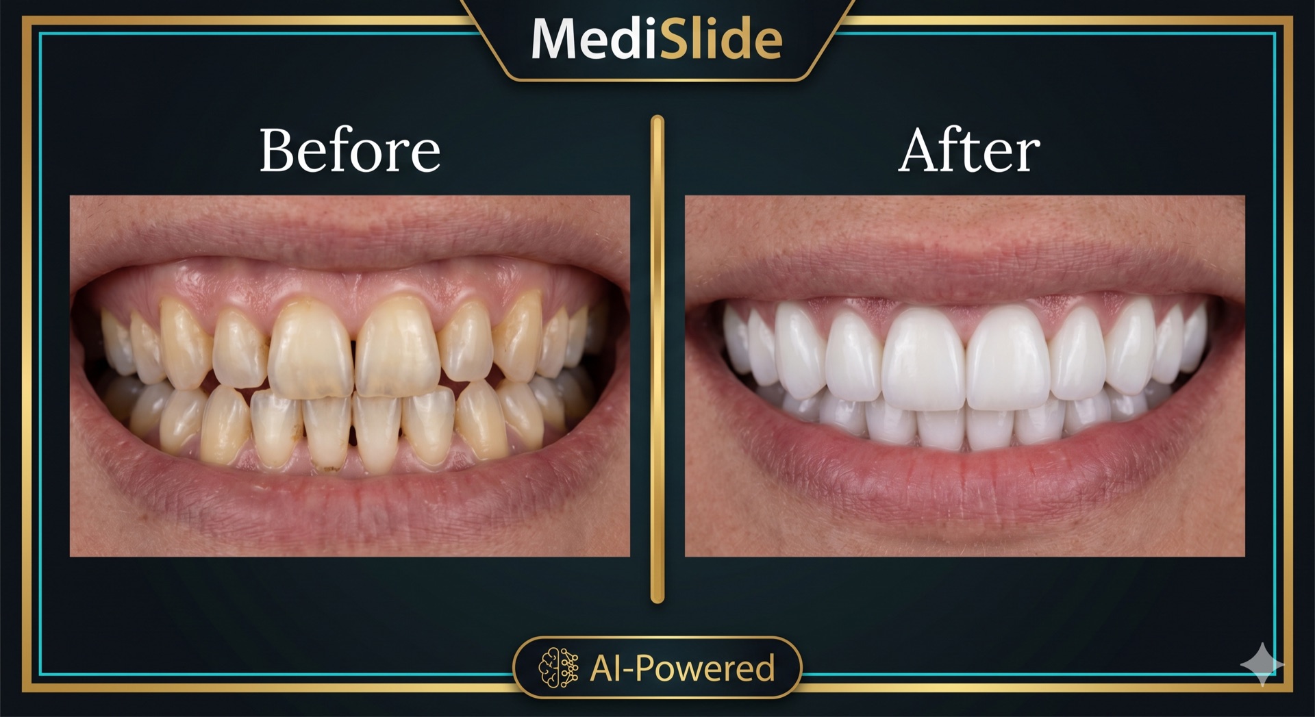 MediSlide