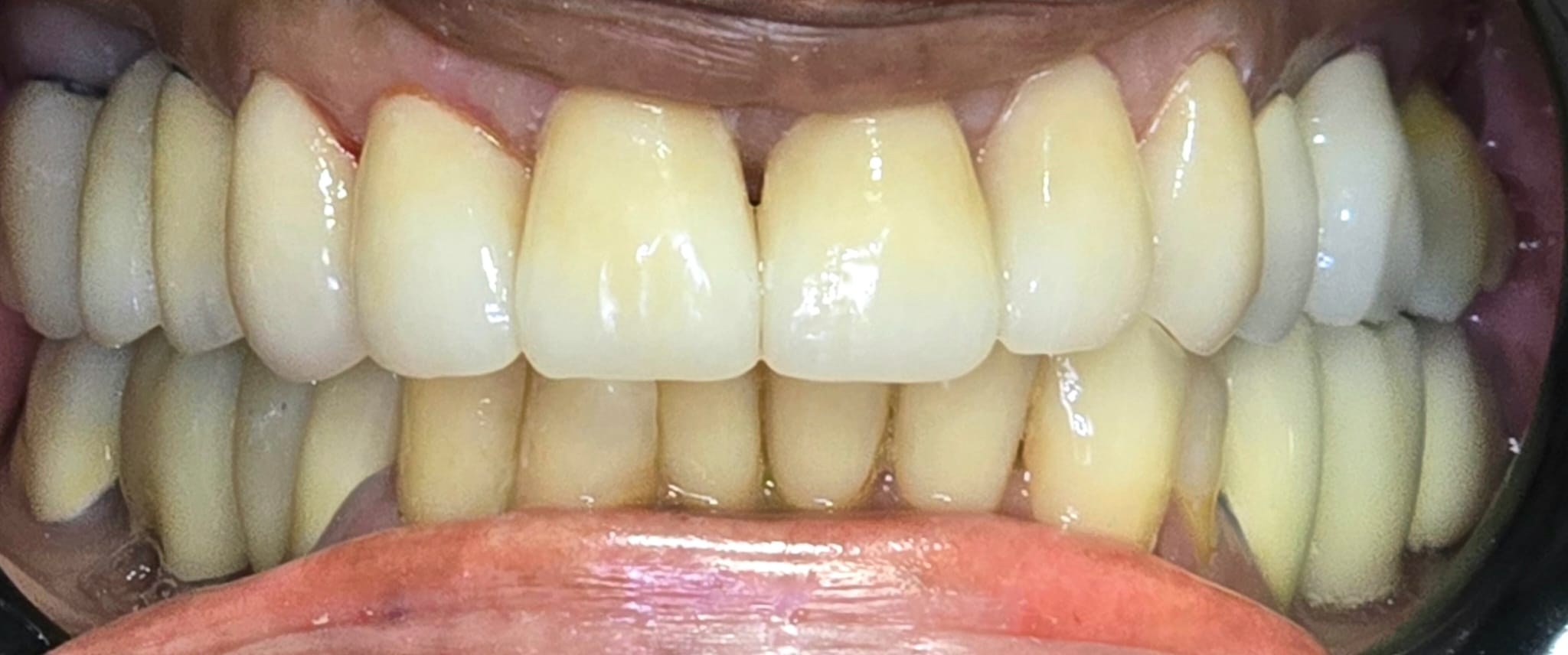 ליאורה אחרי