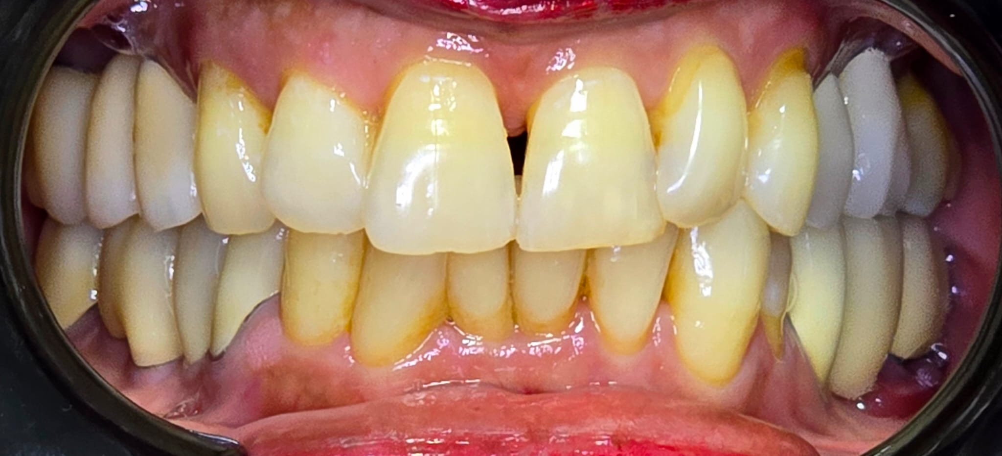 ליאורה לפני